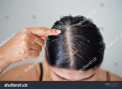 Women Thin Hair There Pulses Hair Stock Photo 1633593190 Shutterstock