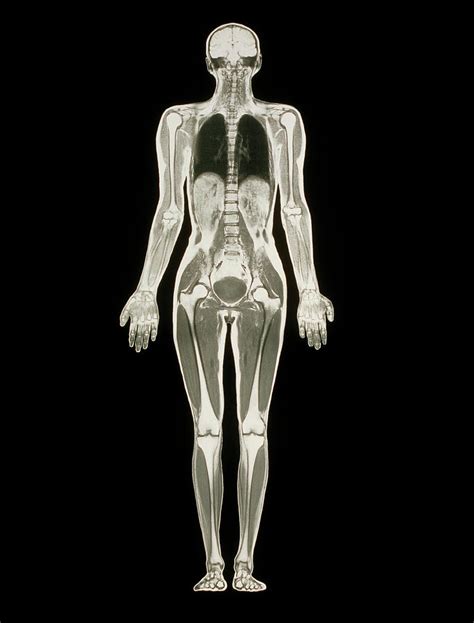 Mri Scan Of A Whole Human Body Female Photograph By Simon Fraser