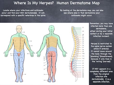 Dermatome Map And Shingles