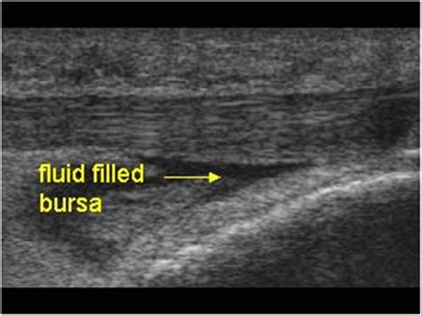 Musculoskeletal Joints And Tendons 66 Knee Case 669 Osgood