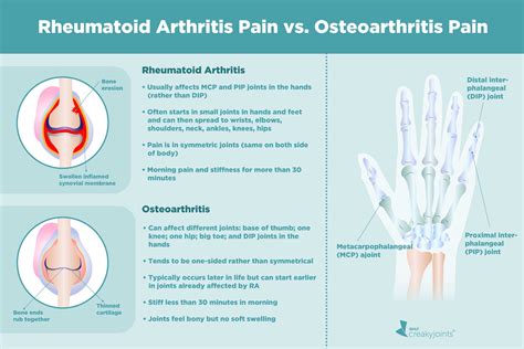 Rheumatoid Arthritis Vs Osteoarthritis Whats The Difference