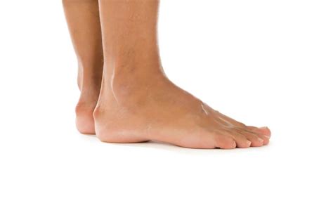 Haglund S Deformity Treatment New York Foot Health Nyspma New