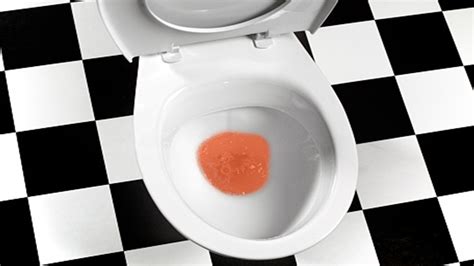 The 5 Reasons Your Pee Might Be Orange And When You Must See A Doctor