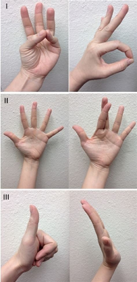 Motor Examination Of The Hand I Median Nerve Ii Ulnar Nerve Iii