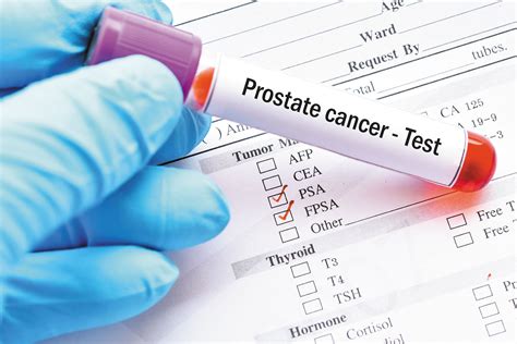 De Nouvelles Méthodes De Dépistage Du Cancer De La Prostate Thepressfree