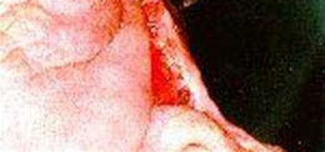 Rotationplasty - Weird Picture Archive