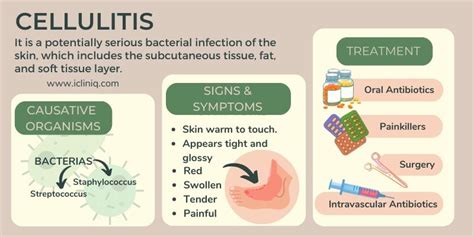 Oral Antibiotics For Skin Infections