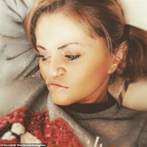 Danniella Westbrook Reveals She Will Undergo Two More Reconstructive Operations Daily Mail Online