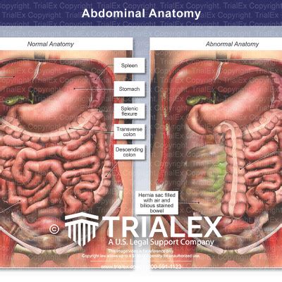 normal and abnormal abdominal anatomy trialexhibits inc