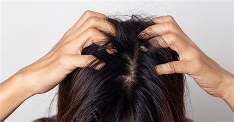 Doctor Warns Against Bizarre And Dangerous Scalp Popping Trend