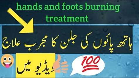 Remedy For Burning Feets And Handshath Paon Ki Jalan Ka Ilaajhand Burning Treatmentik