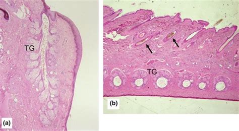 Histological Aspect Of Tarsal Glands Tg In A Control Eyelid A