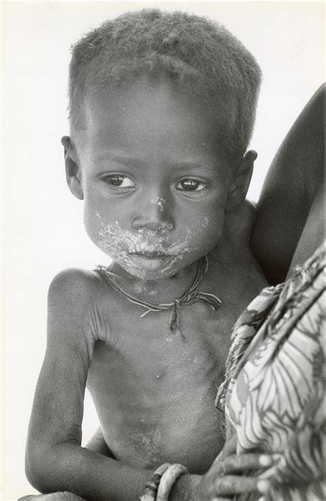 Lot Vintage Real Photo Iconic Starving Child African 1984