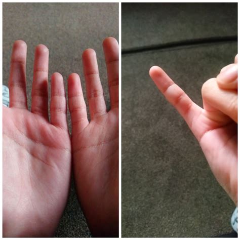 My Right Pinky Has An Extra Square R Mildlyinteresting