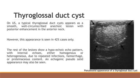 Cystic Neck Masses