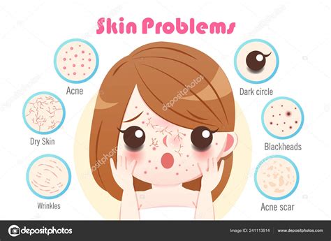 Cute Cartoon Woman Skin Problem White Background Stock Vector By