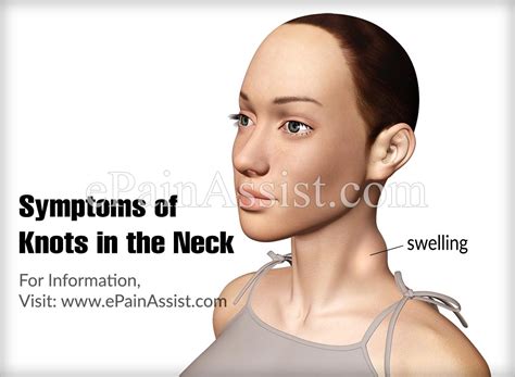 Symptoms Of Knots In The Neck Picture