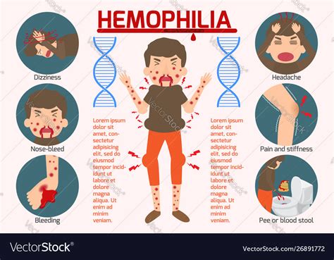 Hemophilia Symptom Infographics Elements Sign Vector Image