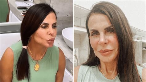 Gretchen mostra resultado de nova harmonização facial aos fãs