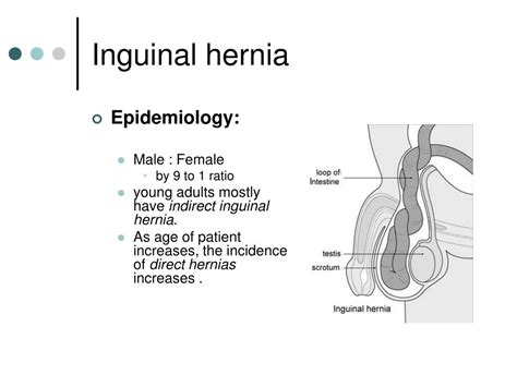 Inguinal Hernia Female Symptoms Inguinal Hernia Pictures Learn