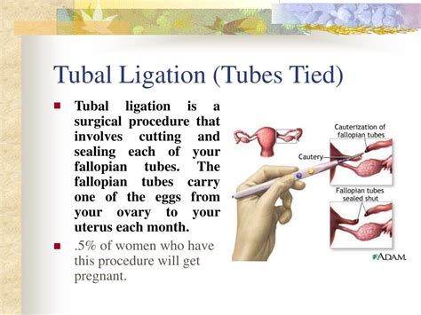 Ppt 3 Ways Hormonal Birth Control Methods Work Powerpoint