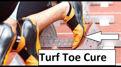 Turf Toe Treatment Rehab Turf Toe Plate And Taping Home Guide