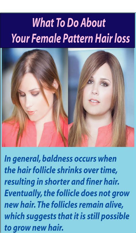 You Can Tackle Hair Loss Naturally With Images Female Pattern Hair