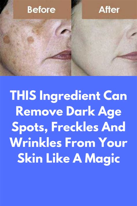 this ingredient can remove dark age spots freckles and wrinkles from your skin like a magic
