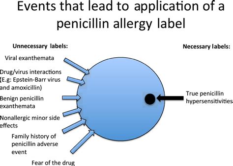 The Challenge Of De‐labeling Penicillin Allergy Stone 2020
