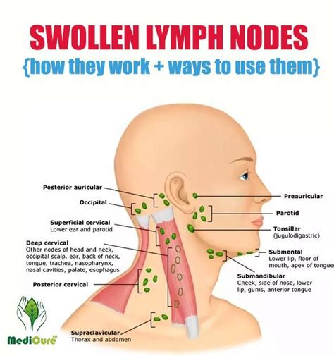 Diabetes Swollen Lymph Nodes Neck Diabeteswalls