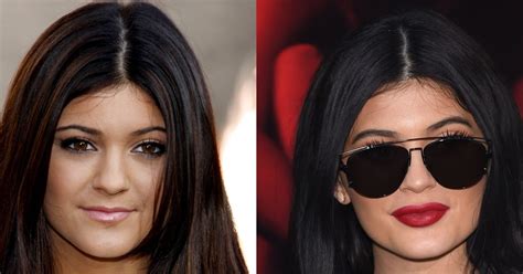 kylie jenner s plastic surgery face before and after photos