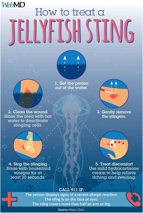 Jellyfish Stings Jellyfish Sting Jellyfish Craft Jellyfish Tattoo
