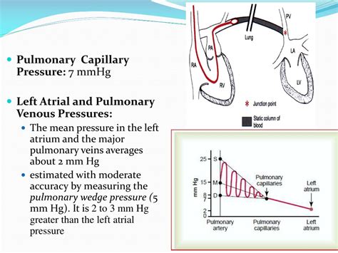 Ppt Chapter 38 Pulmonary Circulation Pulmonary Edema Pleural Fluid