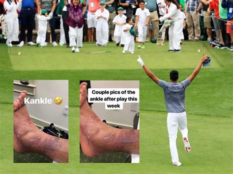 Flashback Tony Finau Dislocates Ankle And Finishes Top 10 At The