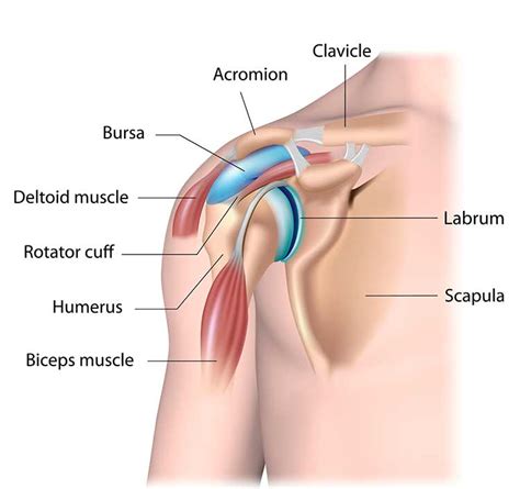 Shoulder Tendinitis And Bursitis Aka Swelling Inflammation Within The