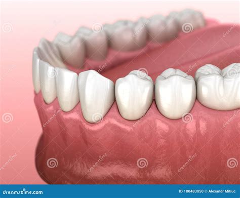 Mandibular Human Gum And Teeth Anatomy Medically Accurate Tooth Stock