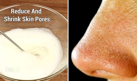 Home Remedies For Open Pores Top 10 Home Remedies
