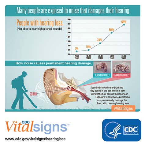 Non Occupational Noise Induced Hearing Loss Cdc Online Newsroom Cdc