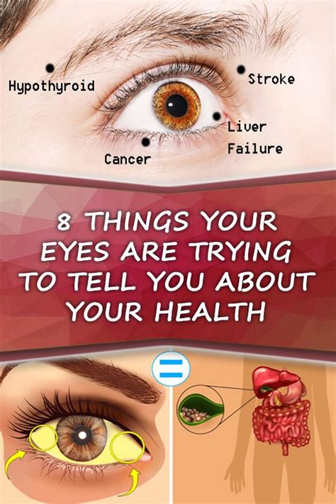 8 Things Your Eyes Can Tell You About Your Health Health And Tips