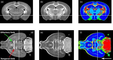 Whole Mouse Brain Imaging Using Optical Coherence Tomography