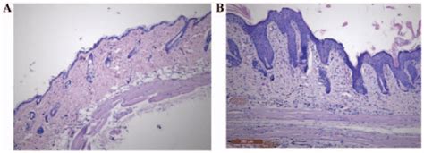 Histopathological Evaluation Of Mouse Skin Samples Hande Staining A
