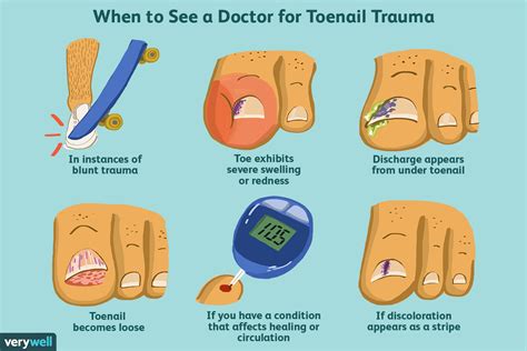 When To Seek Treatment For Toenail Trauma