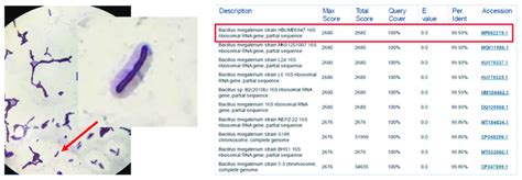 Bacillus Megaterium A Grans Staining And Identification Results