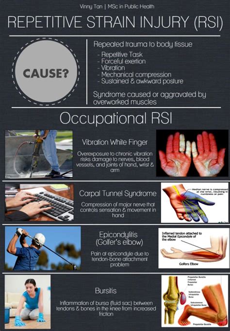Repetitive Strain Injury An Occupational Injury Repetitive Strain