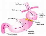 Gastric Clinic Pictures
