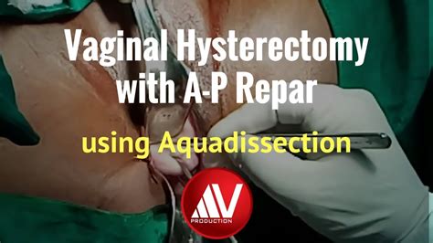 Vaginal Hysterectomy With Ap Repair Using Aqua Dissection Youtube