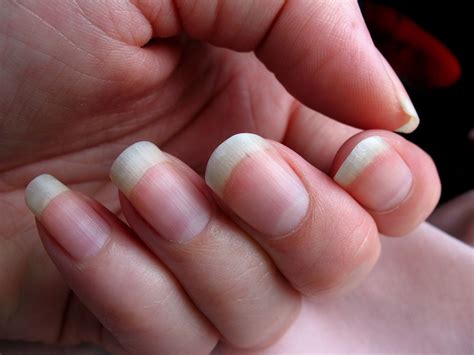 Whats Up With That Your Fingernails Grow Way Faster Than Your Toenails Wired