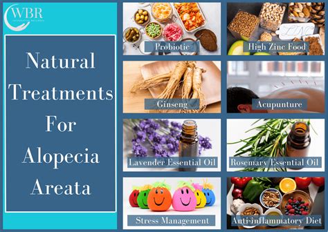 How To Manage Alopecia Areata Naturally Wellness By Rosh