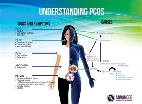 Polycystic Ovarian Syndrome Symptoms And Causes Funendercom