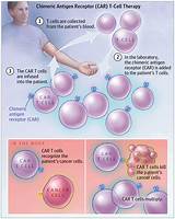 Photos of Modified T Cells Cancer Treatment